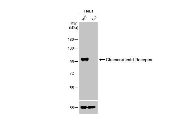 Glucocorticoid receptor (NR3C1) Antibody in Western Blot (WB)