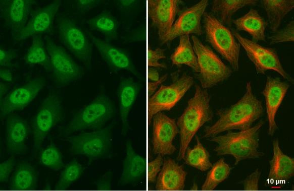 Glucocorticoid receptor (NR3C1) Antibody in Immunocytochemistry (ICC/IF)