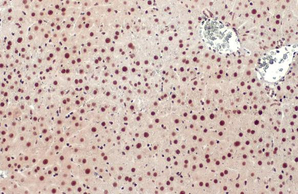 Glucocorticoid receptor (NR3C1) Antibody in Immunohistochemistry (Paraffin) (IHC (P))