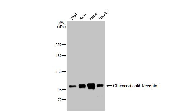 Glucocorticoid receptor (NR3C1) Antibody in Western Blot (WB)