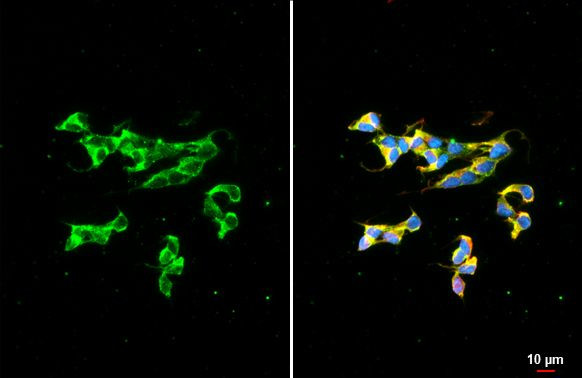 Dopamine beta Hydroxylase Antibody in Immunocytochemistry (ICC/IF)