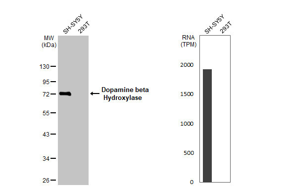 Dopamine beta Hydroxylase Antibody in Western Blot (WB)