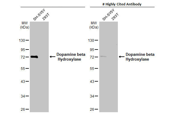 Dopamine beta Hydroxylase Antibody in Western Blot (WB)