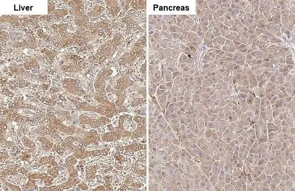 CPT1A Antibody in Immunohistochemistry (Paraffin) (IHC (P))