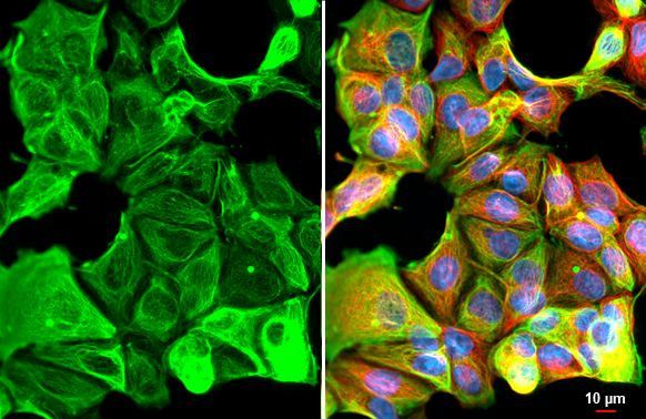 Cytokeratin 19 Antibody in Immunocytochemistry (ICC/IF)