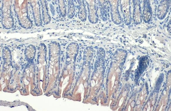 Cytokeratin 19 Antibody in Immunohistochemistry (Paraffin) (IHC (P))