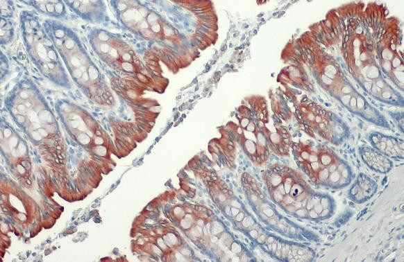 Cytokeratin 19 Antibody in Immunohistochemistry (Paraffin) (IHC (P))