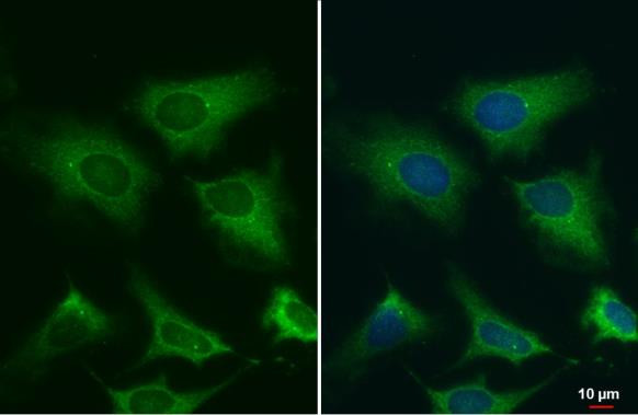 gamma Tubulin Antibody in Immunocytochemistry (ICC/IF)