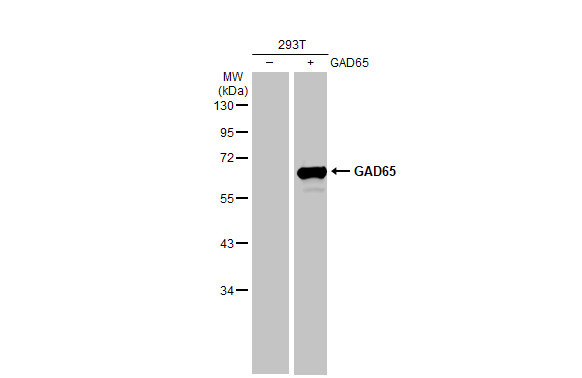 GAD65/GAD67 Antibody in Western Blot (WB)