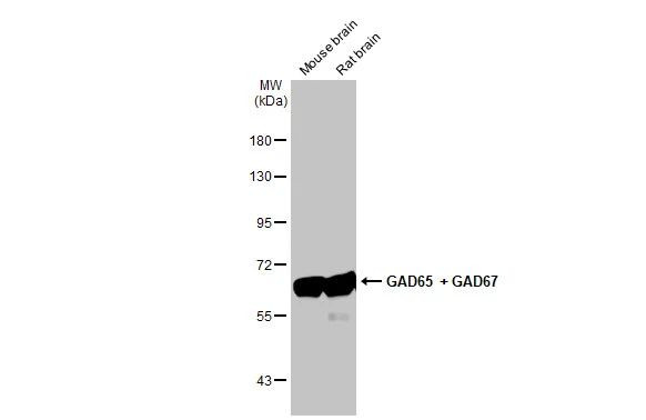 GAD65/GAD67 Antibody in Western Blot (WB)