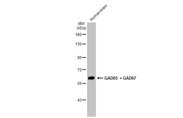 GAD65/GAD67 Antibody in Western Blot (WB)