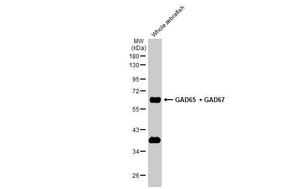 GAD65/GAD67 Antibody in Western Blot (WB)