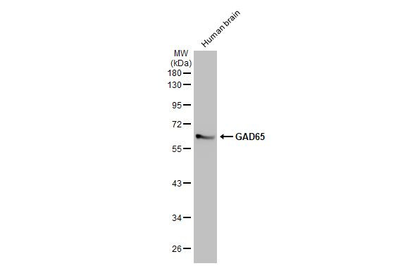 GAD65 Antibody in Western Blot (WB)