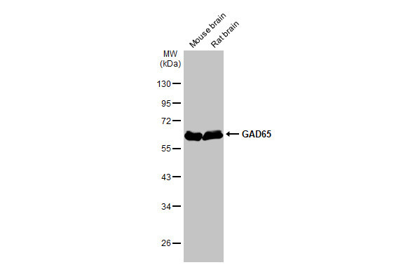 GAD65 Antibody in Western Blot (WB)