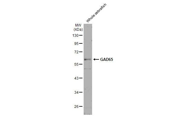 GAD65 Antibody in Western Blot (WB)