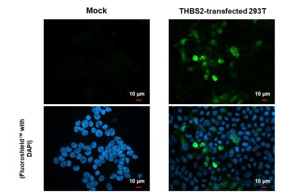 Thrombospondin 2 Antibody in Immunocytochemistry (ICC/IF)