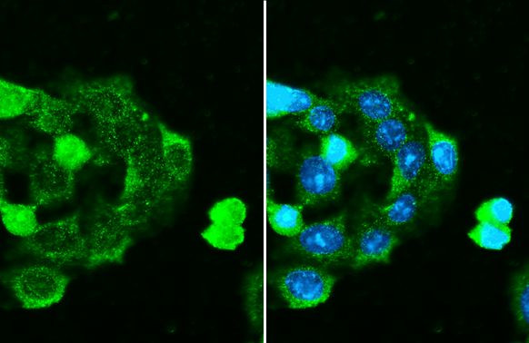 C1 inhibitor Antibody in Immunocytochemistry (ICC/IF)