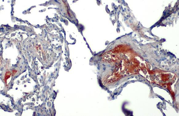 C1 inhibitor Antibody in Immunohistochemistry (Paraffin) (IHC (P))