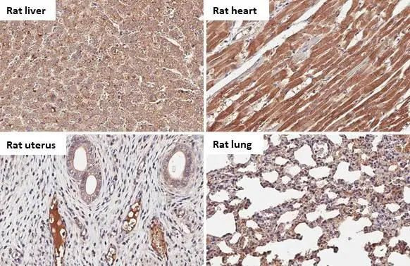 C1 inhibitor Antibody in Immunohistochemistry (Paraffin) (IHC (P))