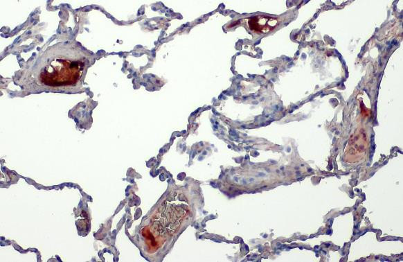 C1 inhibitor Antibody in Immunohistochemistry (Paraffin) (IHC (P))