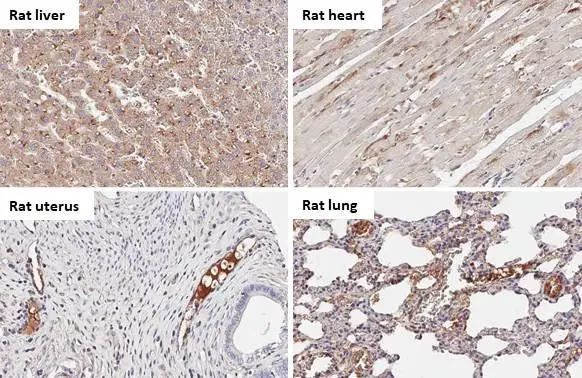 C1 inhibitor Antibody in Immunohistochemistry (Paraffin) (IHC (P))