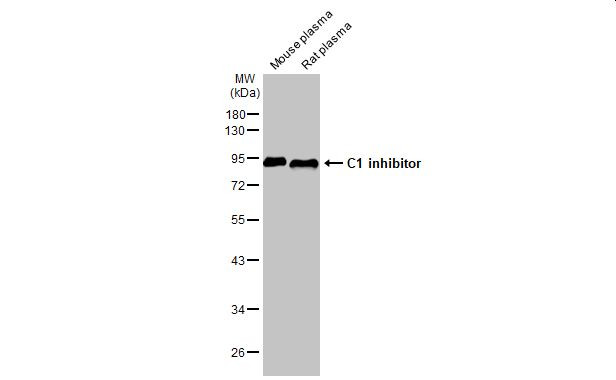 C1 inhibitor Antibody in Western Blot (WB)