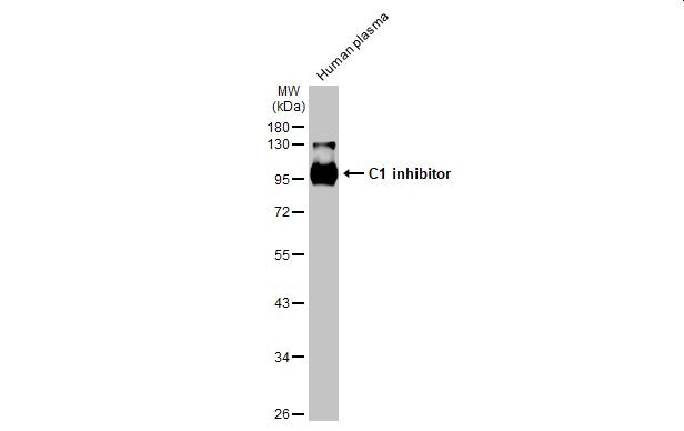 C1 inhibitor Antibody in Western Blot (WB)