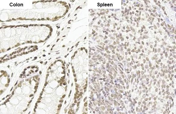 MMP2 Antibody in Immunohistochemistry (Paraffin) (IHC (P))