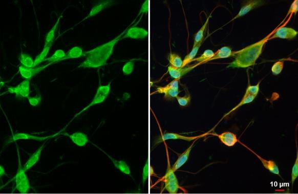 MMP2 Antibody in Immunocytochemistry (ICC/IF)