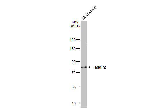 MMP2 Antibody in Western Blot (WB)