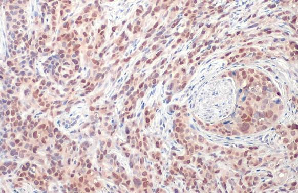 DUT Antibody in Immunocytochemistry (ICC/IF)