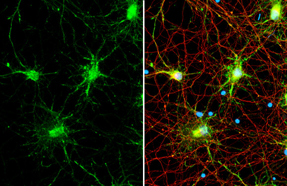 iNOS Antibody in Immunocytochemistry (ICC/IF)