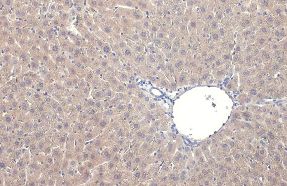 iNOS Antibody in Immunohistochemistry (Paraffin) (IHC (P))