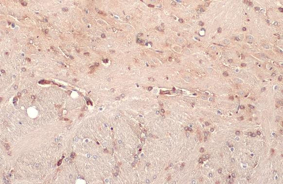 NUP62 Antibody in Immunohistochemistry (Paraffin) (IHC (P))