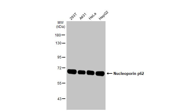 NUP62 Antibody in Western Blot (WB)