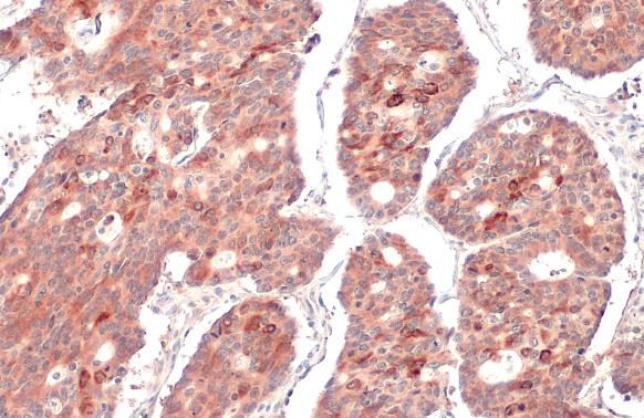 RRM1 Antibody in Immunohistochemistry (Paraffin) (IHC (P))