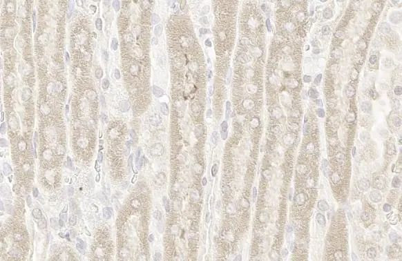 RRM1 Antibody in Immunohistochemistry (Paraffin) (IHC (P))