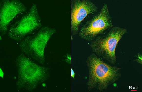 RRM1 Antibody in Immunocytochemistry (ICC/IF)