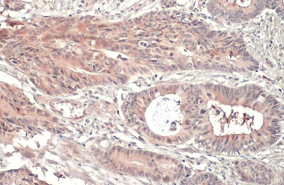 RRM1 Antibody in Immunohistochemistry (Paraffin) (IHC (P))