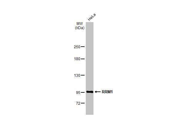 RRM1 Antibody in Western Blot (WB)