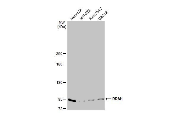 RRM1 Antibody in Western Blot (WB)