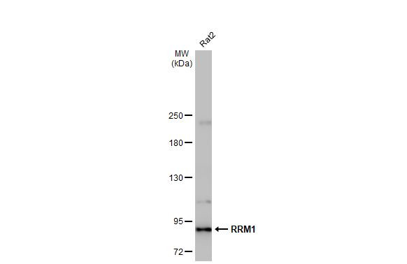 RRM1 Antibody in Western Blot (WB)