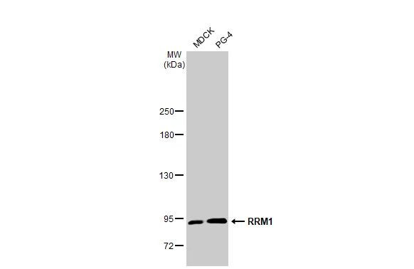 RRM1 Antibody in Western Blot (WB)