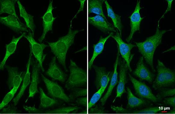 RRM2 Antibody in Immunocytochemistry (ICC/IF)