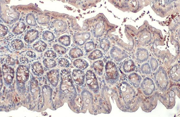 RRM2 Antibody in Immunohistochemistry (Paraffin) (IHC (P))