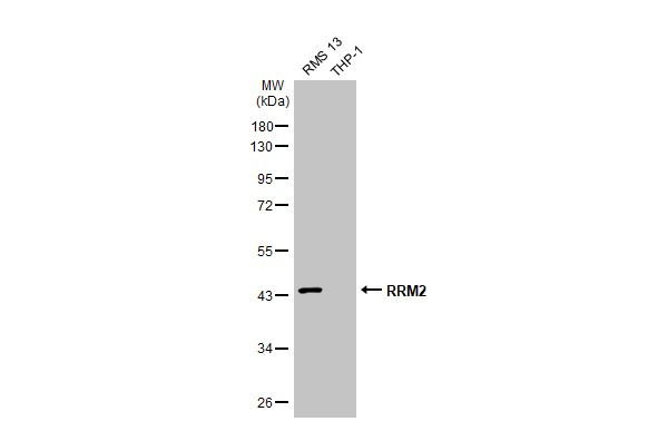 RRM2 Antibody in Western Blot (WB)