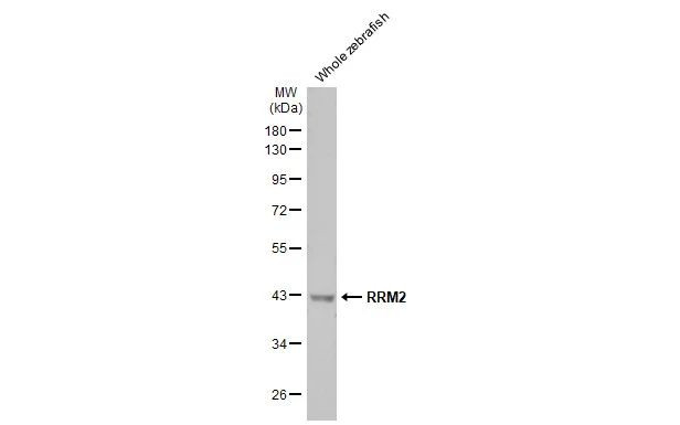 RRM2 Antibody in Western Blot (WB)