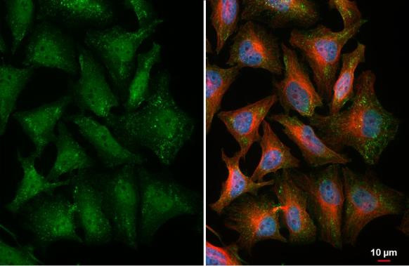 Thymidylate Synthase Antibody in Immunocytochemistry (ICC/IF)