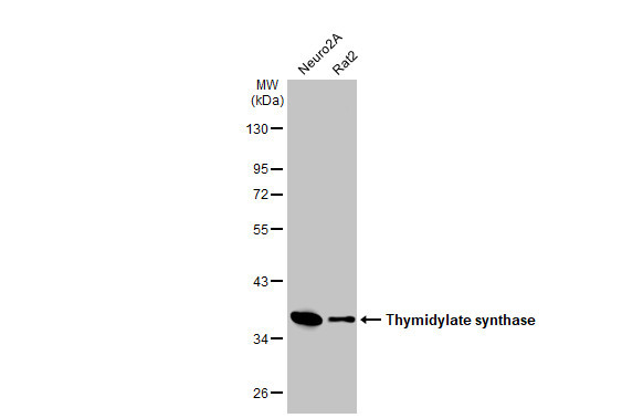 Thymidylate Synthase Antibody in Western Blot (WB)