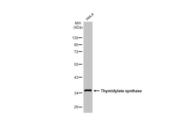 Thymidylate Synthase Antibody in Western Blot (WB)